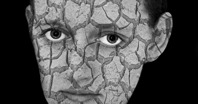 Pénurie de dermatologues en zones rurales : le désert médical qui s'aggrave